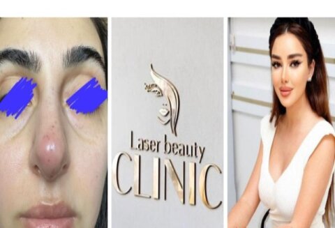 “Laser Beauty Clinic” tam bir QƏSSABXANA kimi işləyir... -