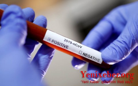 В Азербайджане коронавирусом заразился еще 21 человек