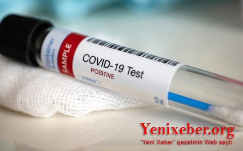 В Азербайджане еще 144 человека заразились коронавирусом