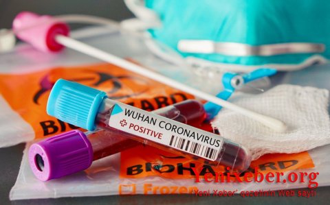В Азербайджане зарегистрировано 337 случаев заражения коронавирусом
