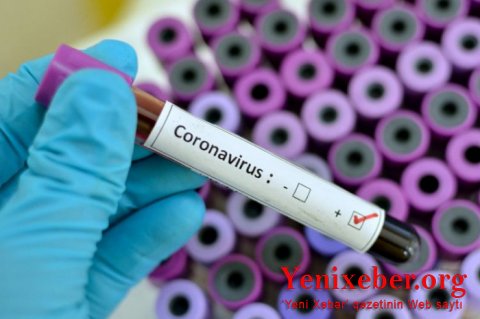 Koronavirus ABŞ və Çinin ortaq layihəsidir? - 
