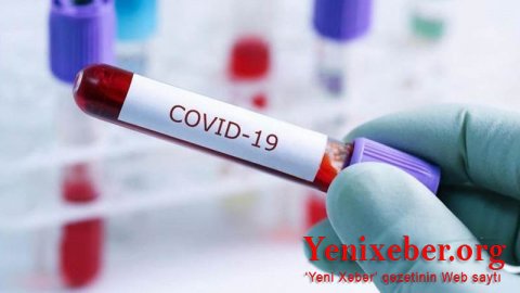 Koronavirusu ən sürətli aşkarlayan test hazırlandı