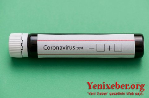 Koronavirus 30 dəqiqəyə aşkar ediləcək-