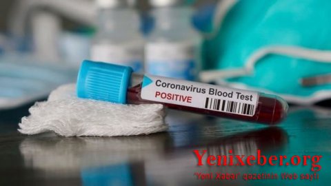 Koronavirus YOX OLUR —